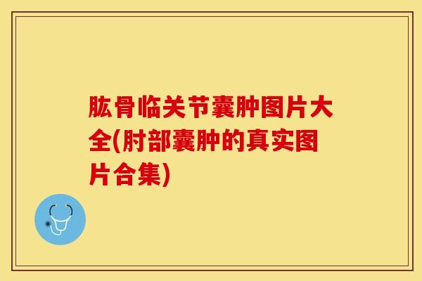 肱骨临关节囊肿图片大全(肘部囊肿的真实图片合集)