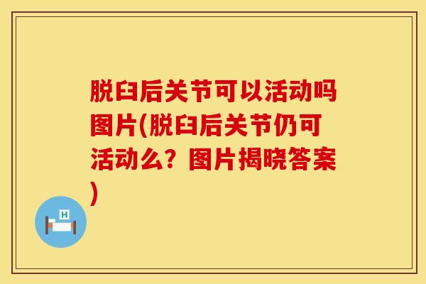 脱臼后关节可以活动吗图片(脱臼后关节仍可活动么？图片揭晓答案)
