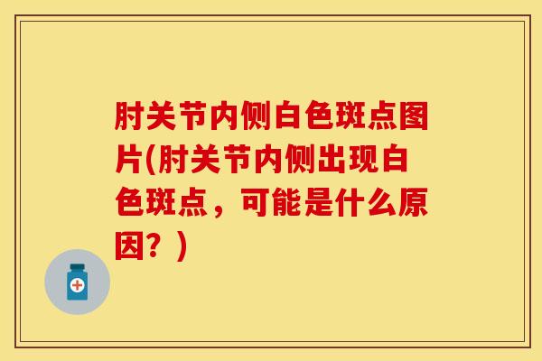 肘关节内侧白色斑点图片(肘关节内侧出现白色斑点，可能是什么原因？)