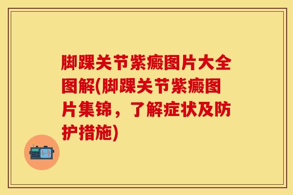 脚踝关节紫癜图片大全图解(脚踝关节紫癜图片集锦，了解症状及防护措施)