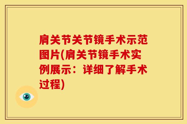 肩关节关节镜手术示范图片(肩关节镜手术实例展示：详细了解手术过程)