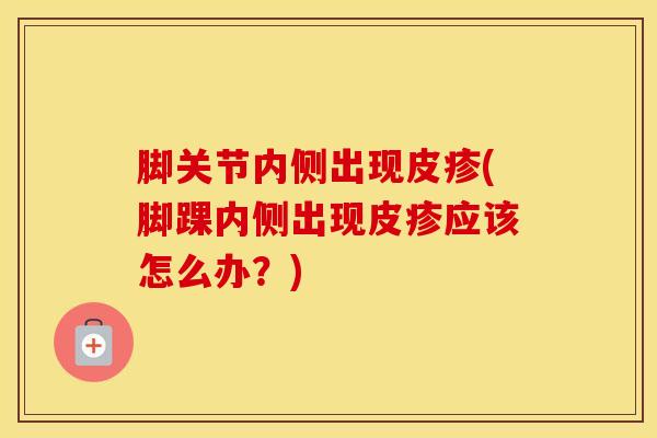 脚关节内侧出现皮疹(脚踝内侧出现皮疹应该怎么办？)