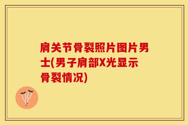 肩关节骨裂照片图片男士(男子肩部X光显示骨裂情况)