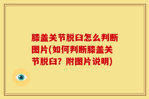 膝盖关节脱臼怎么判断图片(如何判断膝盖关节脱臼？附图片说明)