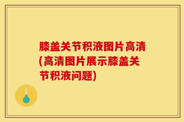膝盖关节积液图片高清(高清图片展示膝盖关节积液问题)