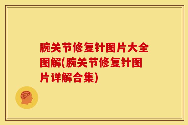 腕关节修复针图片大全图解(腕关节修复针图片详解合集) 腕关节修复针图片大全图解(腕关节修复针图片详解合集)
