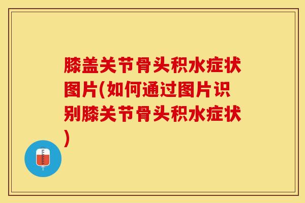 膝盖关节骨头积水症状图片(如何通过图片识别膝关节骨头积水症状)