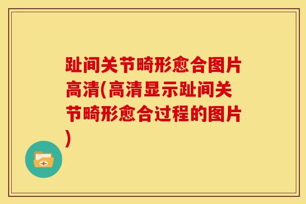 趾间关节畸形愈合图片高清(高清显示趾间关节畸形愈合过程的图片)