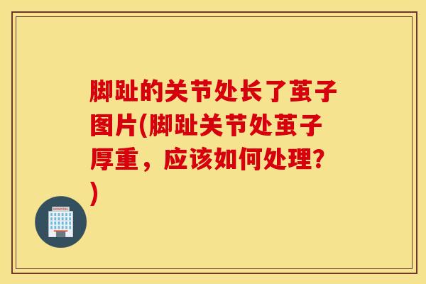 脚趾的关节处长了茧子图片(脚趾关节处茧子厚重，应该如何处理？)
