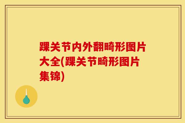 踝关节内外翻畸形图片大全(踝关节畸形图片集锦)