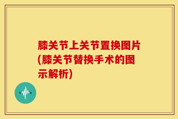 膝关节上关节置换图片(膝关节替换手术的图示解析)