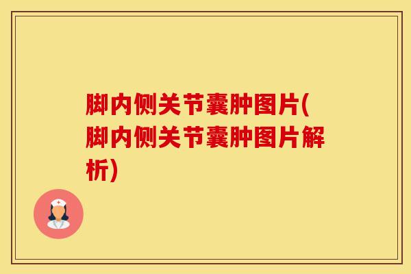 脚内侧关节囊肿图片(脚内侧关节囊肿图片解析)