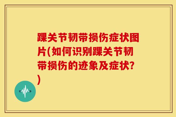 踝关节韧带损伤症状图片(如何识别踝关节韧带损伤的迹象及症状?) 踝关节韧带损伤症状图片(如何识别踝关节韧带损伤的迹象及症状?)