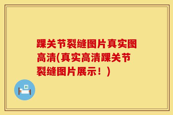 踝关节裂缝图片真实图高清(真实高清踝关节裂缝图片展示！)